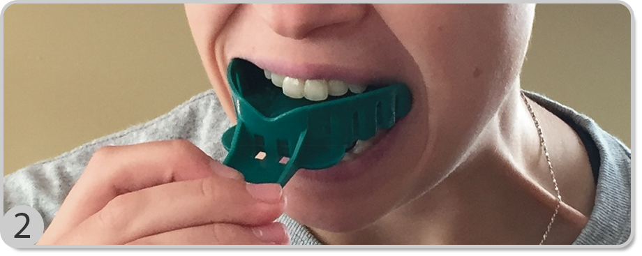 Dental Impression Step Two 